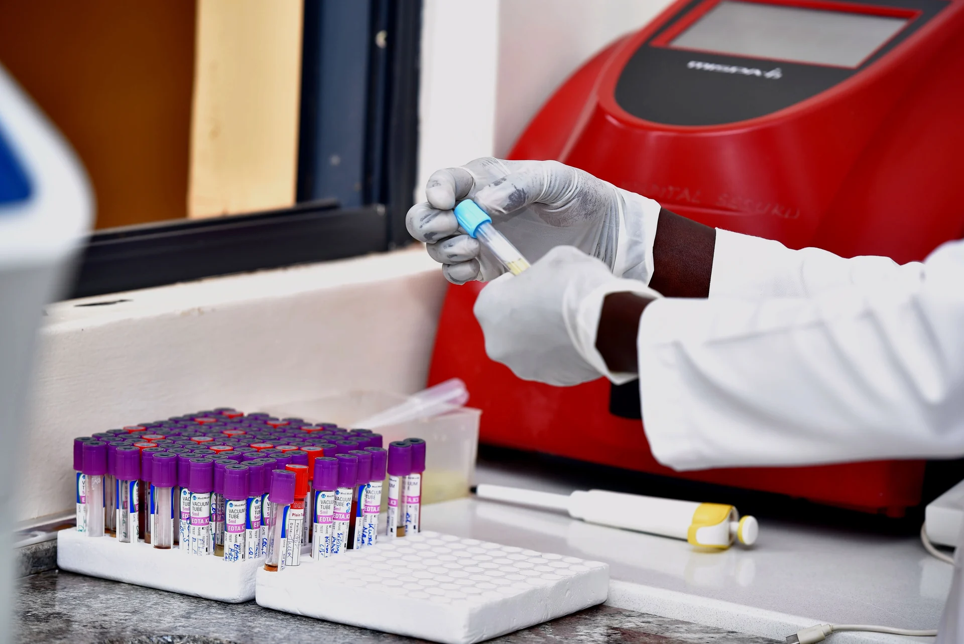 Patient samples being prepared in the laboratory